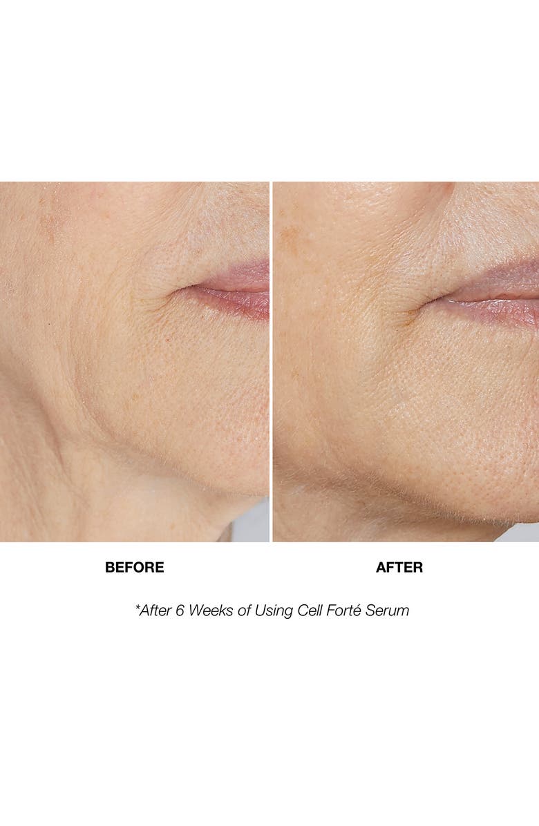 Angela Caglia Cell Forté Serum with BIOMSC<sup>™</sup>, Alternate, color,