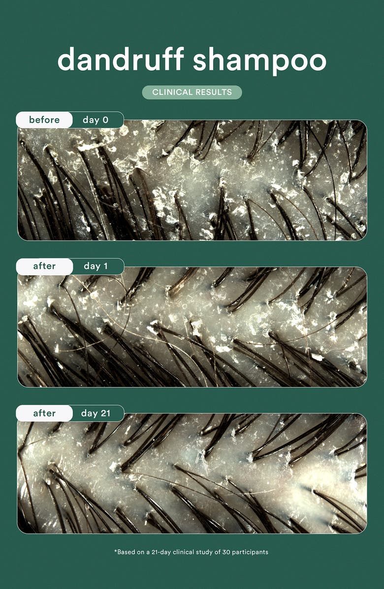 Verb Dandruff Shampoo, Alternate, color, 