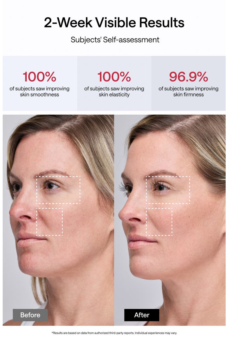 JMOON by Ulike UCollagen+ Microcurrent + LED Light Therapy Device, Alternate, color, UCOLLAGEN / RED