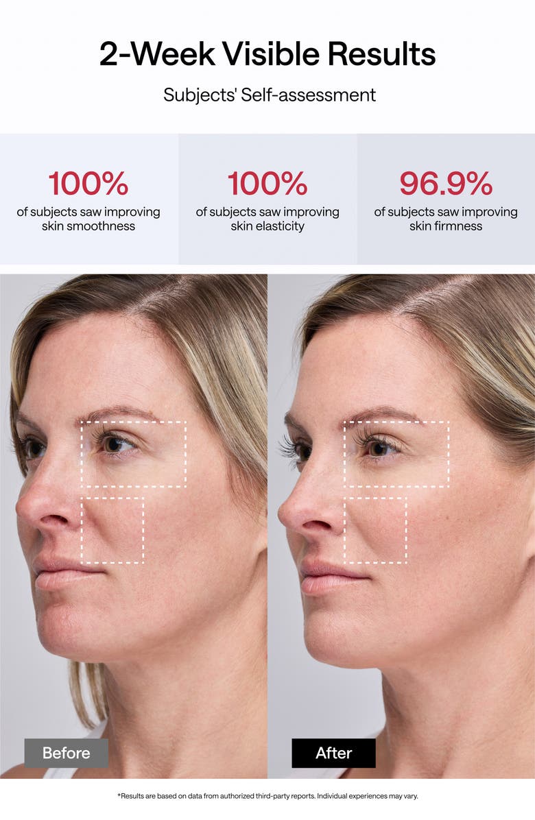 JMOON UCollagen+ Portable Beauty Device Set $499 Value