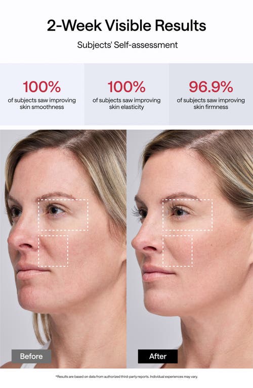 Ulike Jmoon Uncollagen+ Portable Beauty Device Set $499 Value