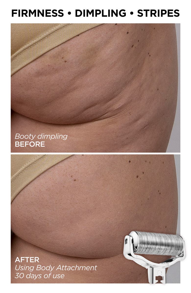 BeautyBio Head to Toe AfterGLO GloPRO<sup>®</sup> Set (Limited Edition) (Nordstrom Exclusive) $317 Value, Alternate, color,