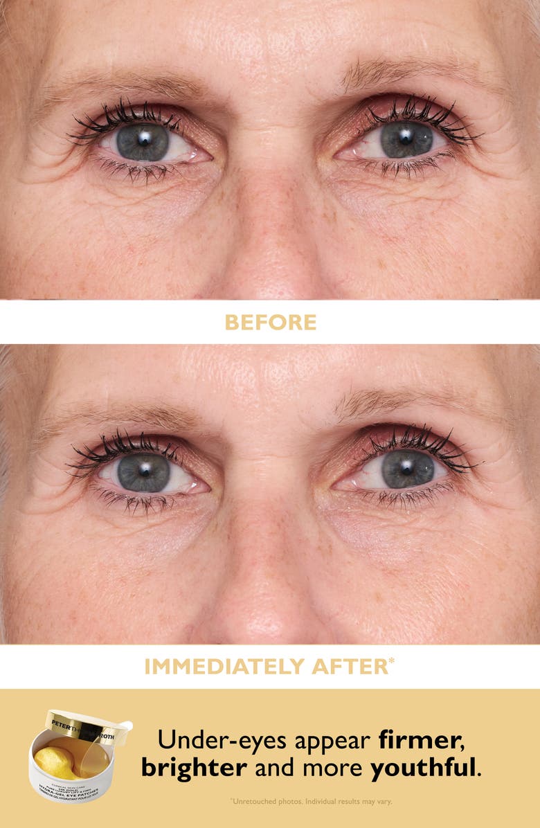 Peter Thomas Roth Patch + Go Eye Patch Set $20 Value, Alternate, color,