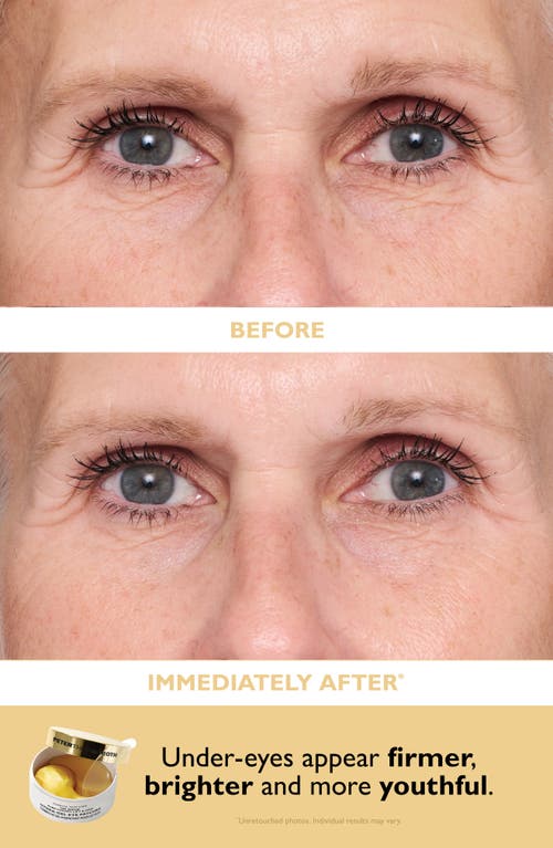 Peter Thomas Roth Patch + Go Eye Patch Set In Transparent