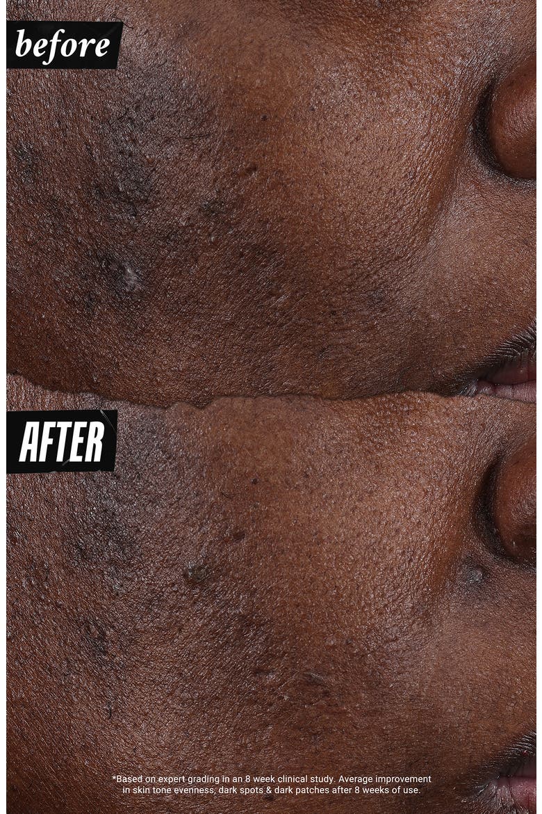 Auto-Tone Discoloration & UV Solution, Alternate, color, NO COLOR