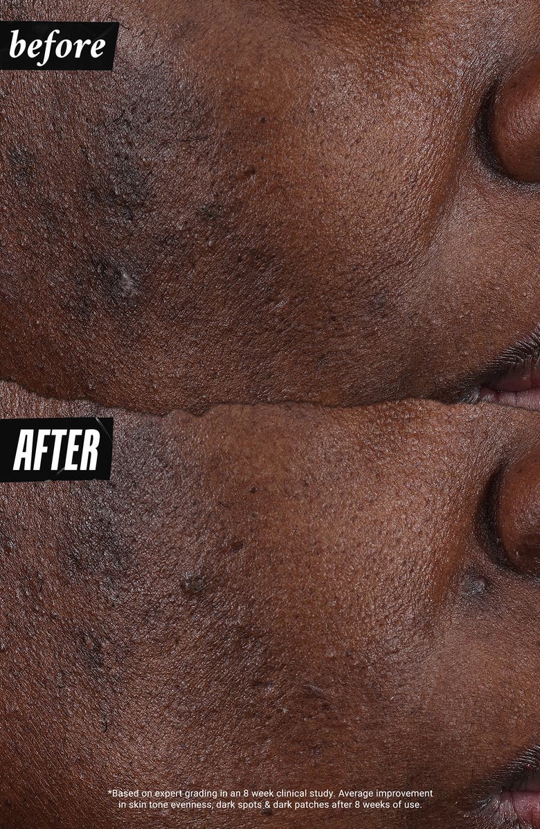 Kiehl's Since 1851 Auto-Tone Discoloration & UV Solution, Alternate, color,