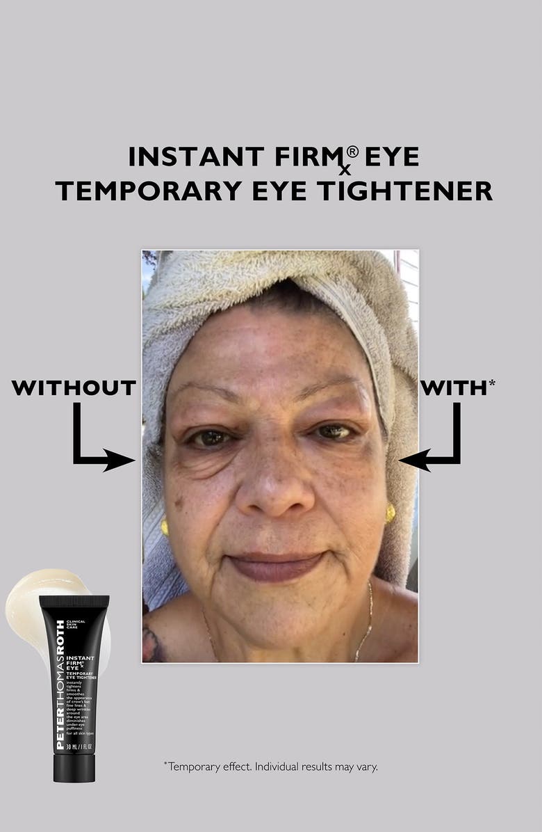 Peter Thomas Roth Instant Firmx<sup>®</sup> 2-Piece Set, Alternate, color, 