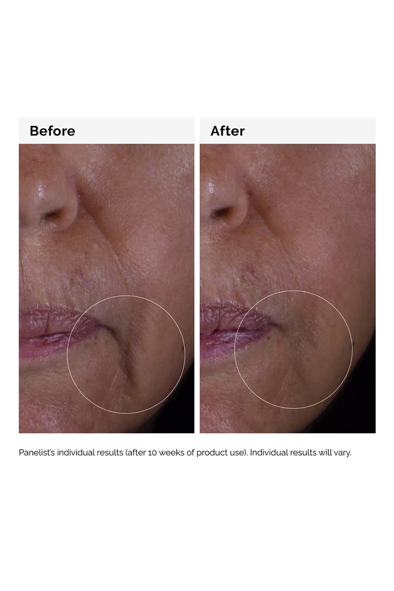 GF 15% Serum for Visible Skin Repair and Wrinkles, Alternate, color, NO COLOR