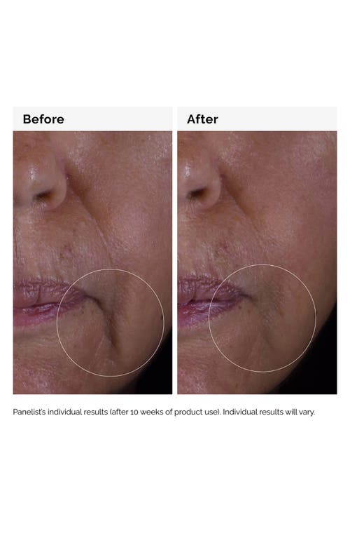 THE ORDINARY THE ORDINARY GF 15% SOLUTION 