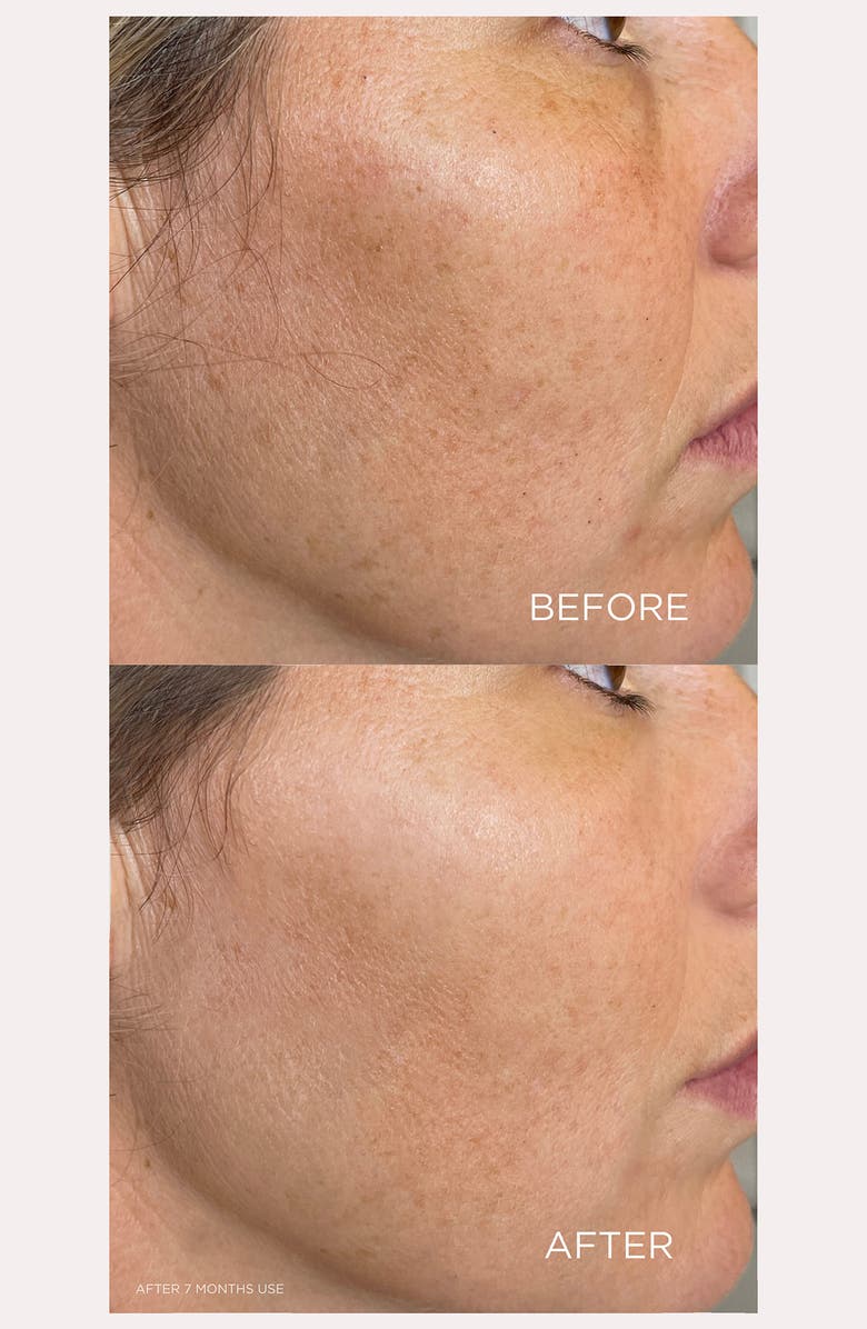 SOLARIS LABORATORIES NY Level Up Gua Sha Massager Device, Alternate, color,