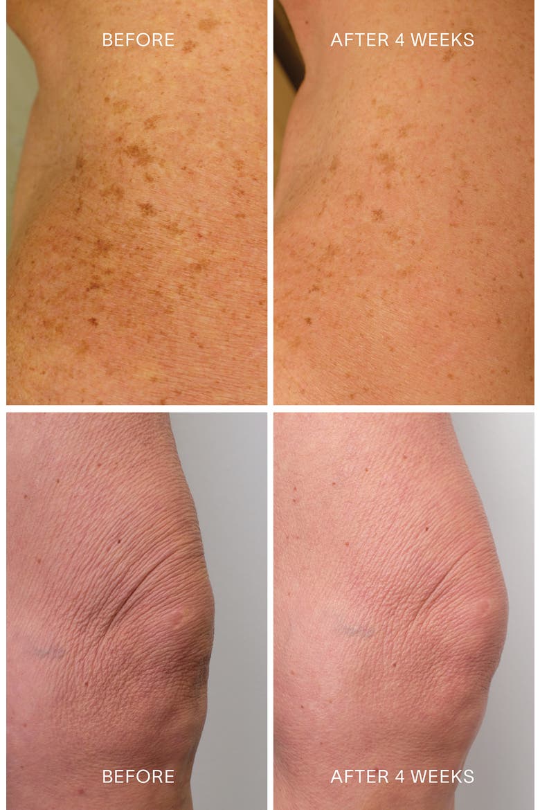Glycolic + Bakuchiol Smoothing Body Treatment, Alternate, color, NO COLOR