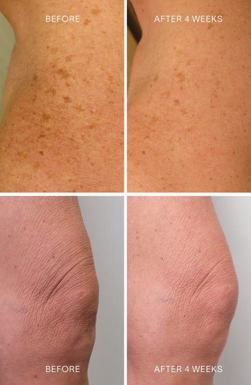 Doctor Rogers Body Repair Treatment Serum In No Color