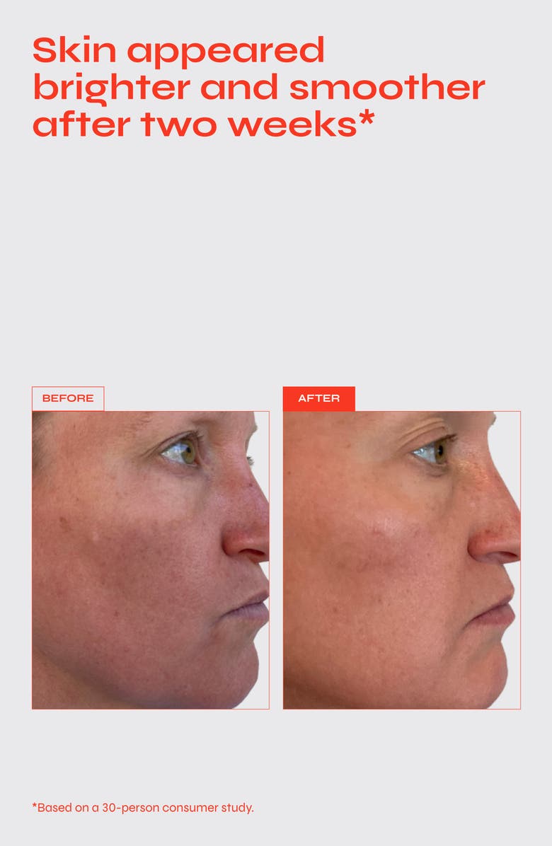 FACILE The Buzz Brightening Exfoliating Facial Treatment with AHA & BHA, Alternate, color, 