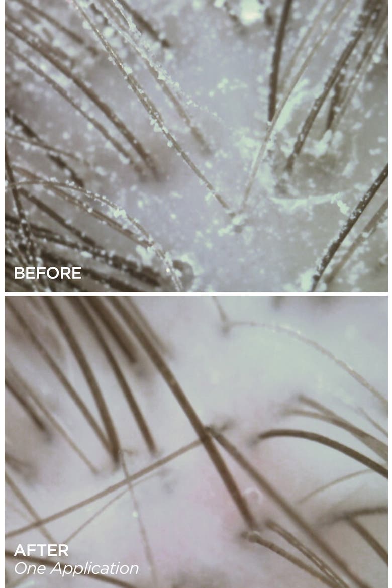 Healthy Scalp Serum Hair Density Treatment, Alternate, color, NO COLOR