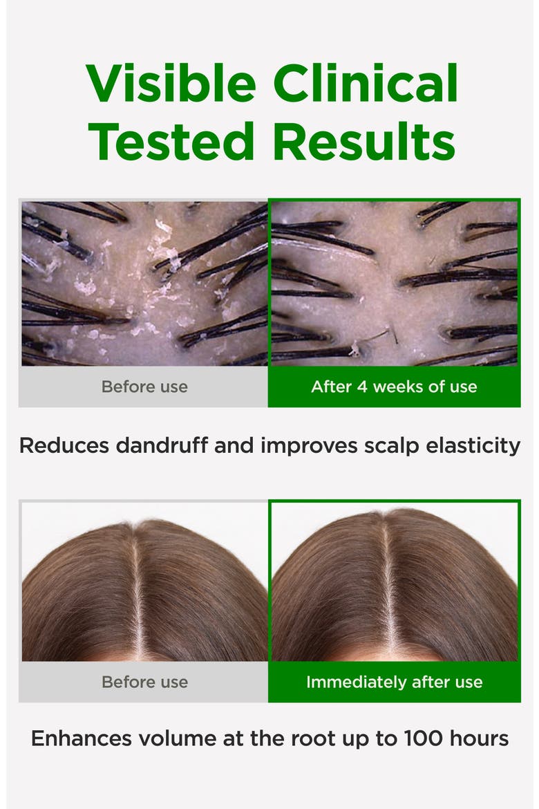 Amino Biotin Hair Treatment, Alternate, color, NO COLOR