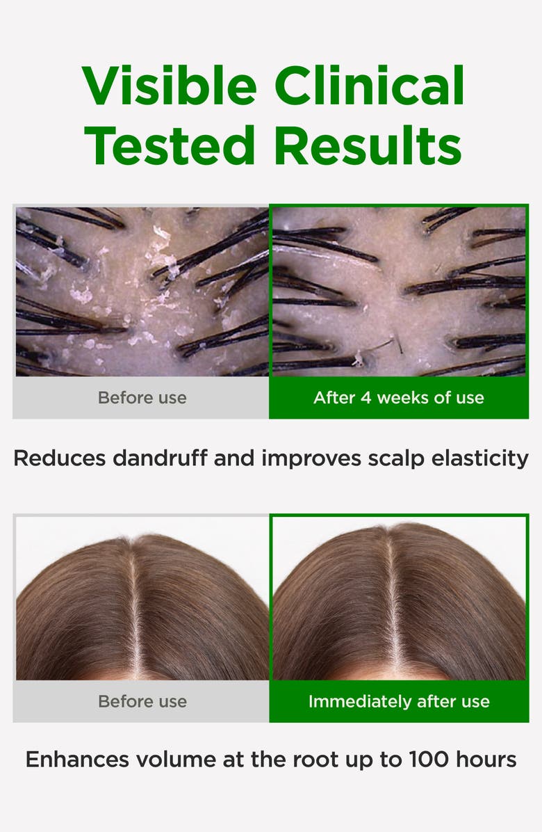 CKD Amino Biotin Hair Treatment, Alternate, color, 
