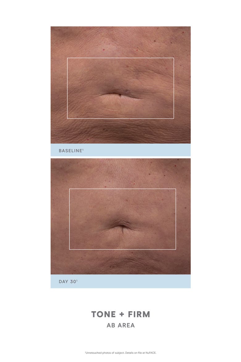 NuBODY Skin Toning Set-$399 Value, Alternate, color, NO COLOR