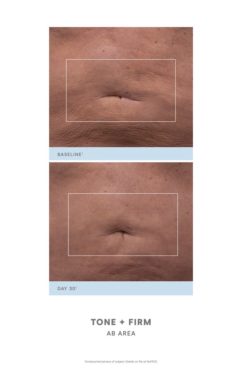 NuFACE<sup>®</sup> NuBODY Skin Toning Set-$399 Value, Alternate, color, 