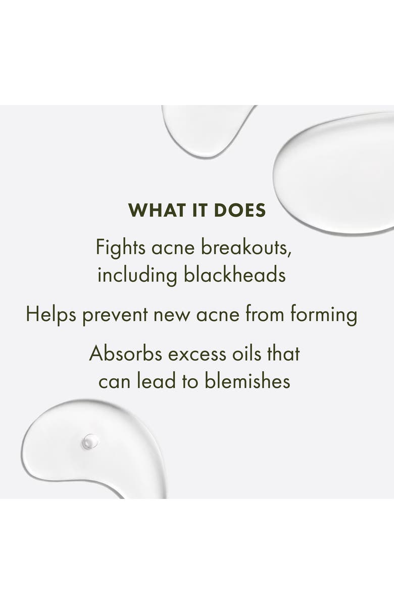 Origins Super Spot Remover<sup>™</sup> Acne Treatment Gel, Alternate, color, 