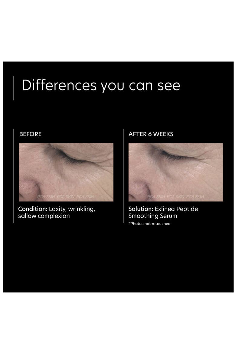 ExLinea Peptide Smoothing Serum, Alternate, color, NO COLOR