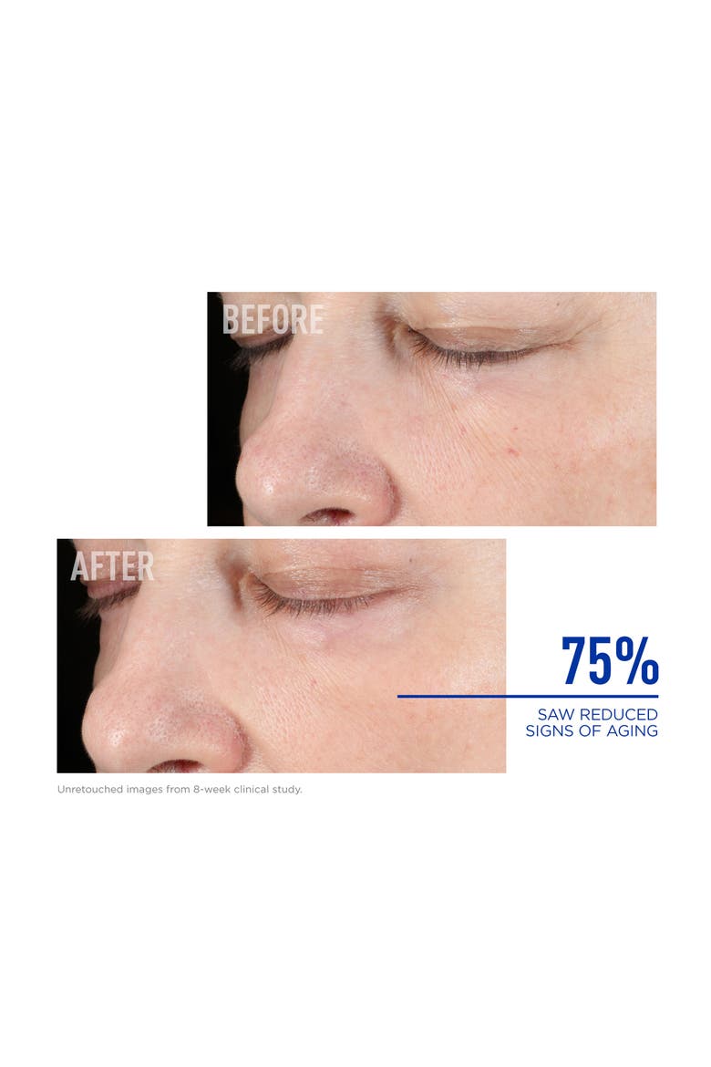 Nighttime BAK-Up™ Retinol Alternative, Alternate, color, NO COLOR