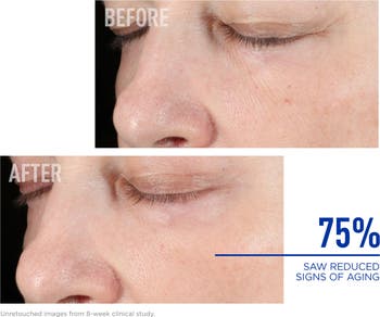 Nighttime BAK-Up<sup>™</sup> Retinol Alternative