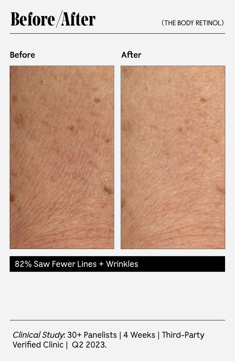 Nécessaire The Body Retinol, Alternate, color,