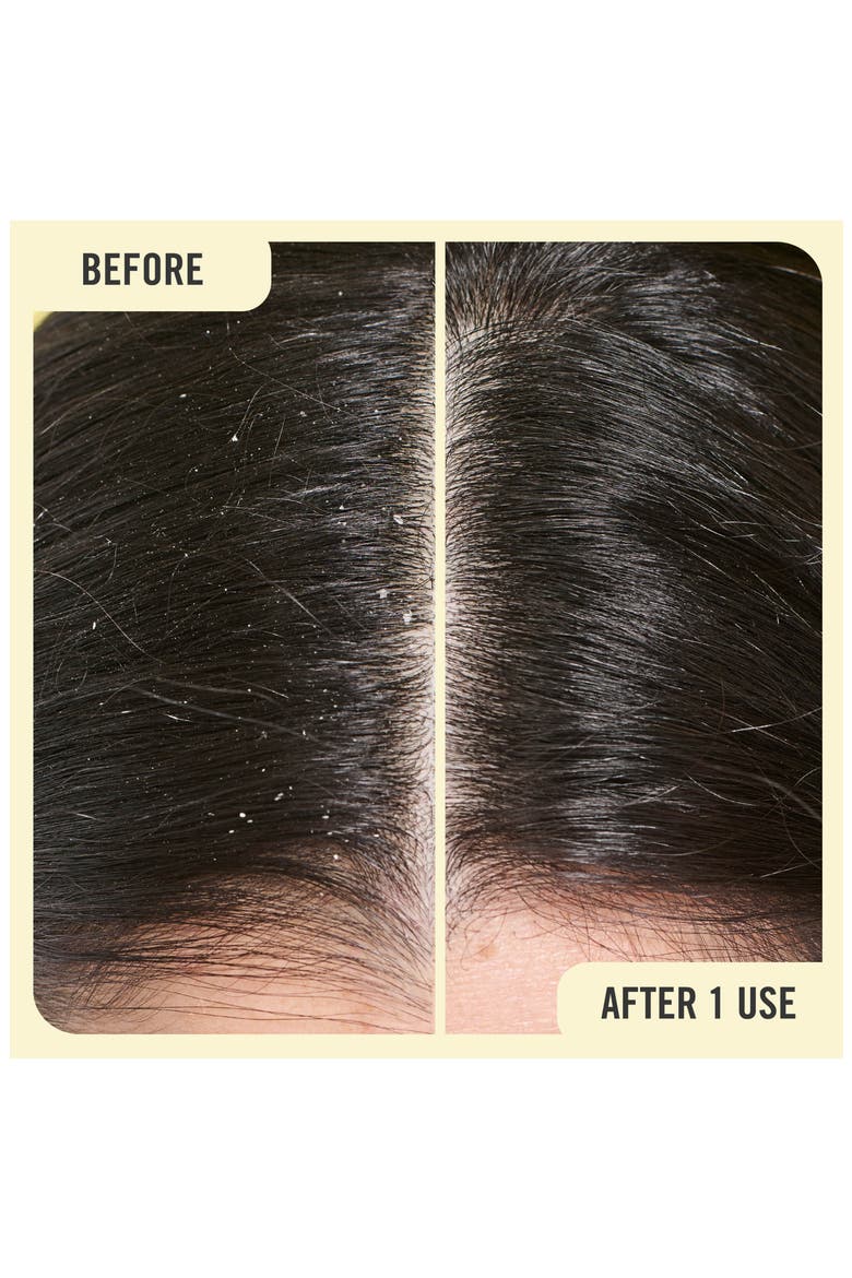 Anti-Dandruff Shampoo, Alternate, color, NO COLOR