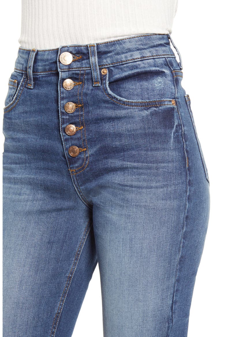 Alicia Button Fly High Waist Crop Mom Jeans, Alternate, color, NORTH SPRINGDALE