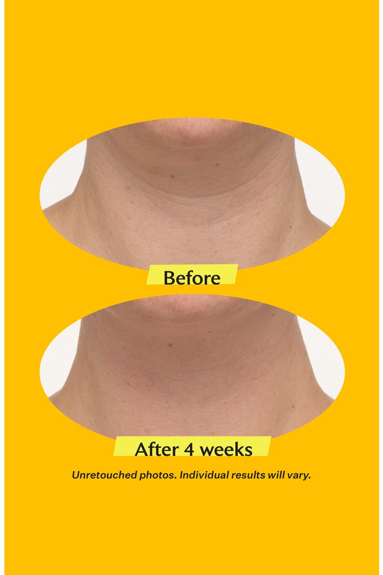 TL Advanced Tightening Neck Cream, Alternate, color, NO COLOR