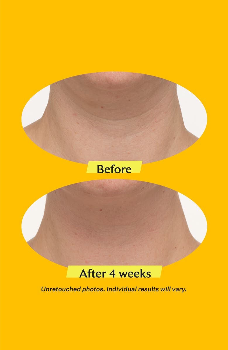 StriVectin<sup>®</sup> TL Advanced Tightening Neck Cream, Alternate, color, 