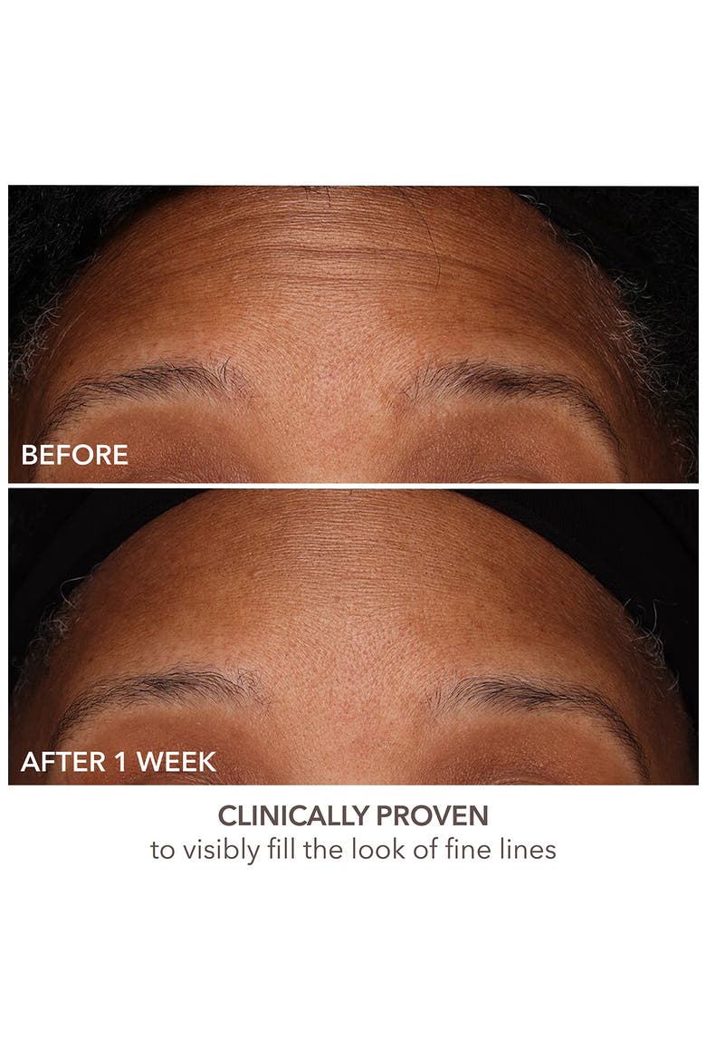 DermInfusions Fill + Repair Serum, Alternate, color, NO COLOR