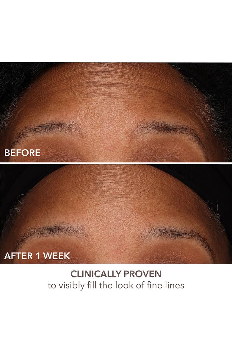 Dr. Dennis Gross Skincare DermInfusions Fill + Repair Serum, Alternate, color, 