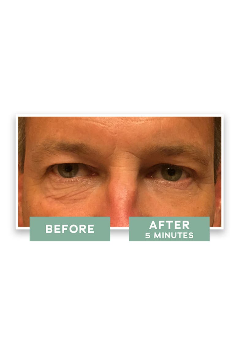 2-in-1 Instant Eye Lift Serum, Alternate, color, NO COLOR