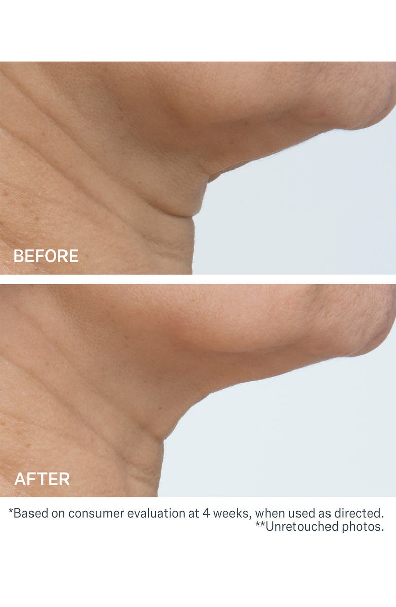 StriVectin<sup>®</sup> -TL<sup>™</sup> 'The Big Deal' Jumbo Advanced Tightening Neck Cream, Alternate, color, 