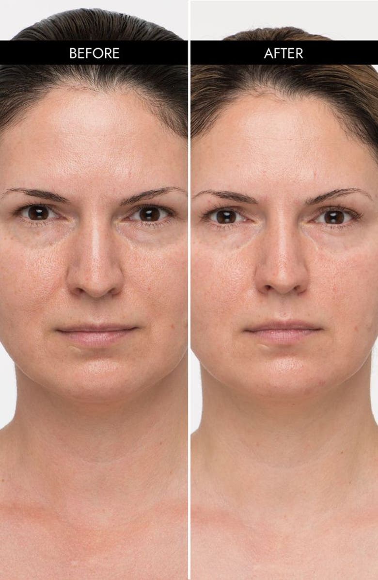 7e Wellness MyoLift Mini Microcurrent Home Care Kit, Alternate, color, NO COLOR