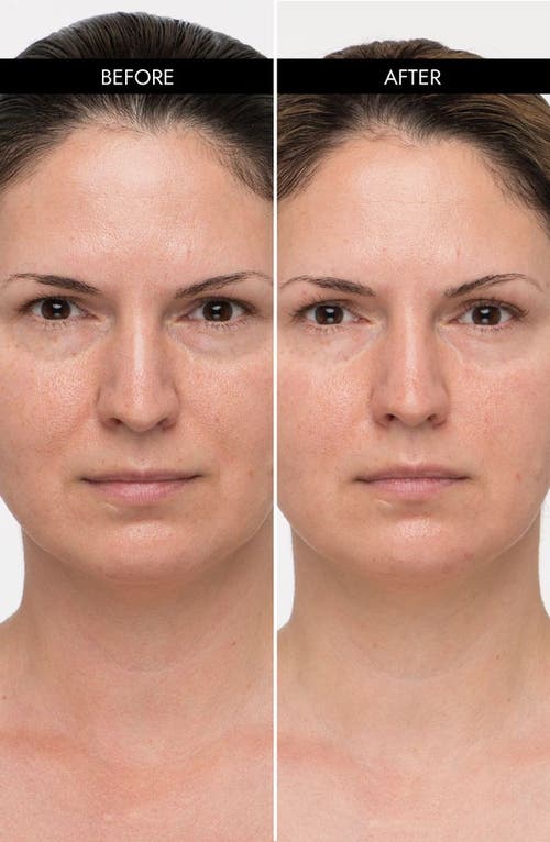 7e Wellness Myolift Mini Microcurrent Bundle Of Joy