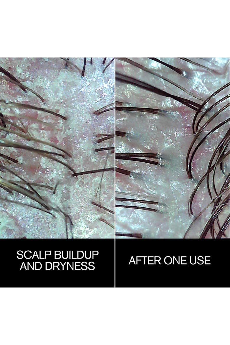 Follicle Drops, Alternate, color, none