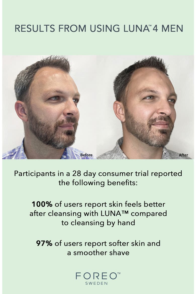 Luna™ 4 Men 2-in-1 Smart Facial Cleansing & Firming Device, Alternate, color, NO COLOR