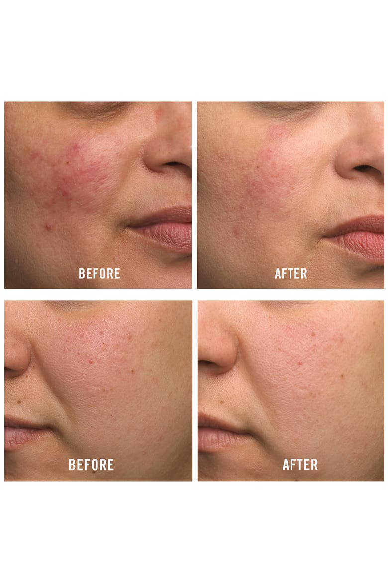Ultra Repair Cream Intense Hydration Face & Body Moisturizer, Alternate, color, NO COLOR