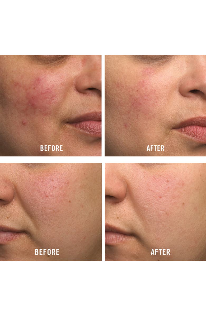 First Aid Beauty Ultra Repair Cream Intense Hydration Face & Body Moisturizer, Alternate, color, 