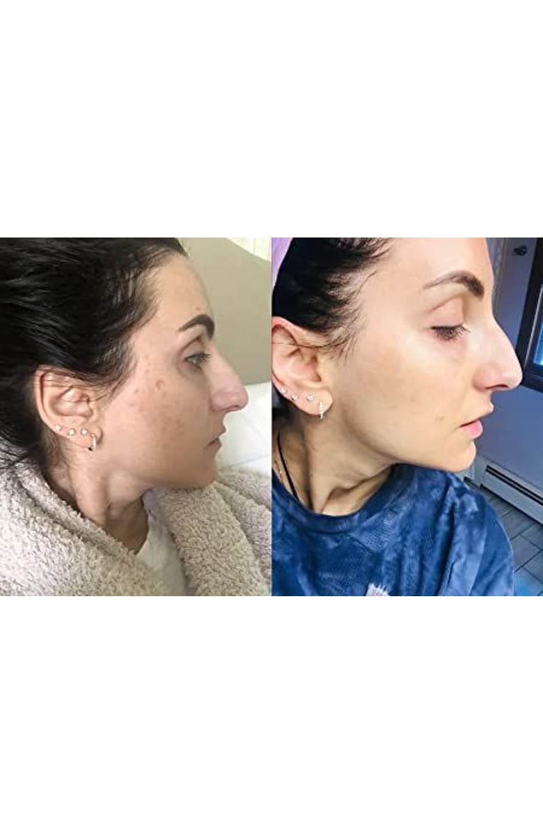 Admire My Skin Ultra Potent Brightening Serum Dark Spot Corrector, Alternate, color, Clear