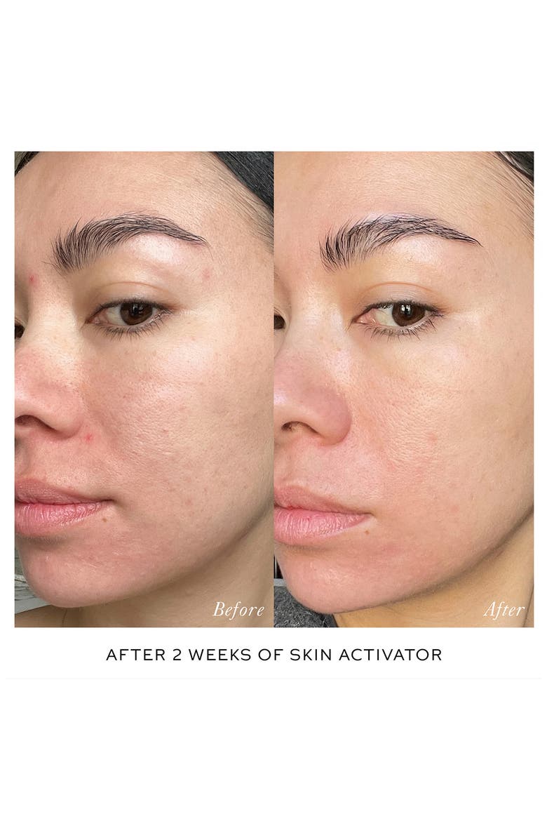 The Activator Serum Duo for Face & Eye $270 Value, Alternate, color, NO COLOR