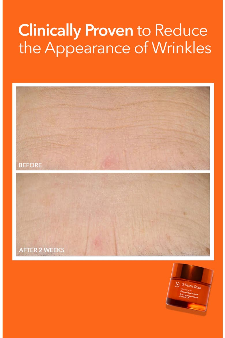 Vitamin C Lactic Dewy Deep Cream Duo $154 Value, Alternate, color, NO COLOR