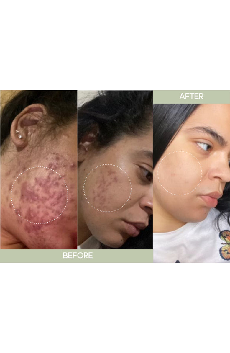 Skinergy Beauty Dark Spot Correcting Cream, Alternate, color, 