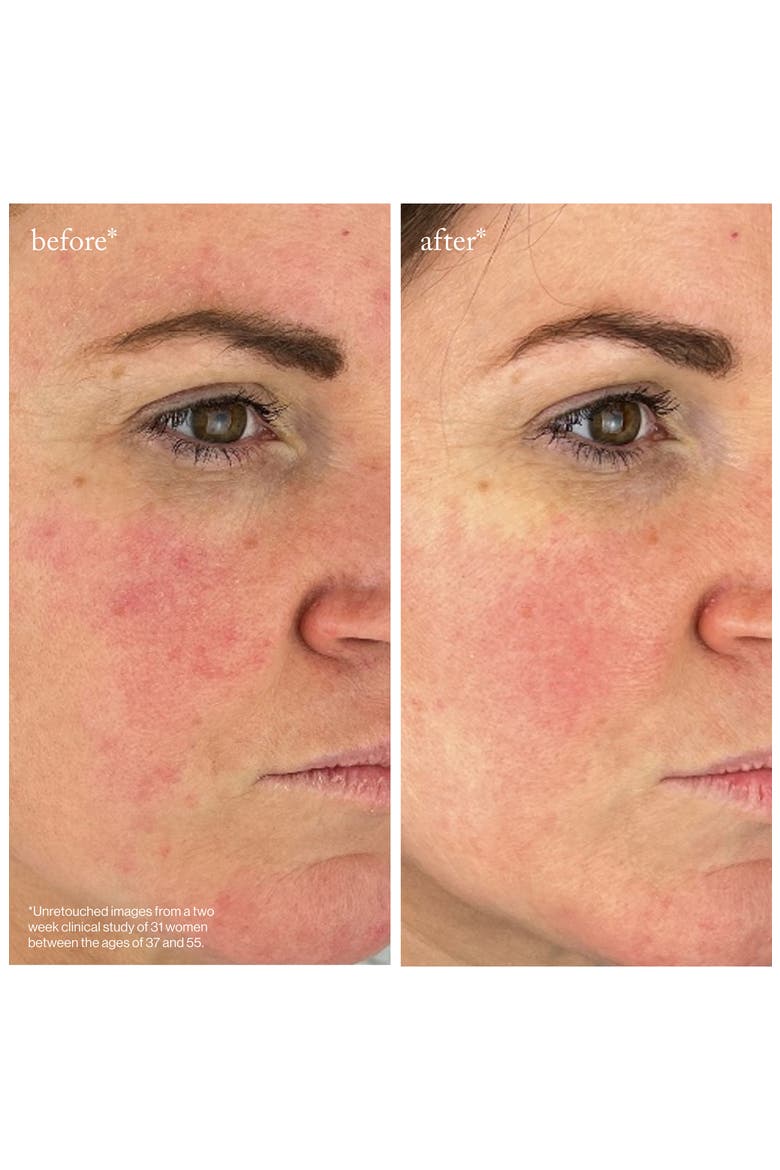 Youth-Boost Peptide Serum, Alternate, color, NO COLOR