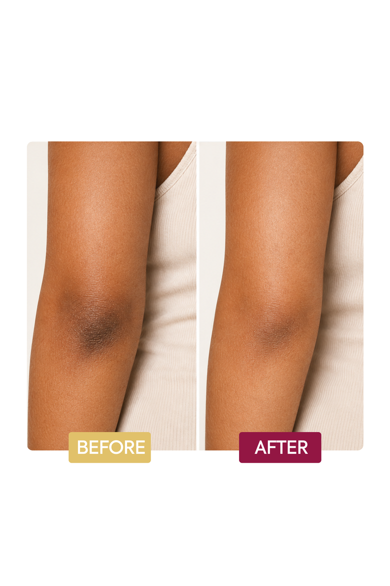 Clarifying Cream Hand, Foot & Elbow, Alternate, color, None