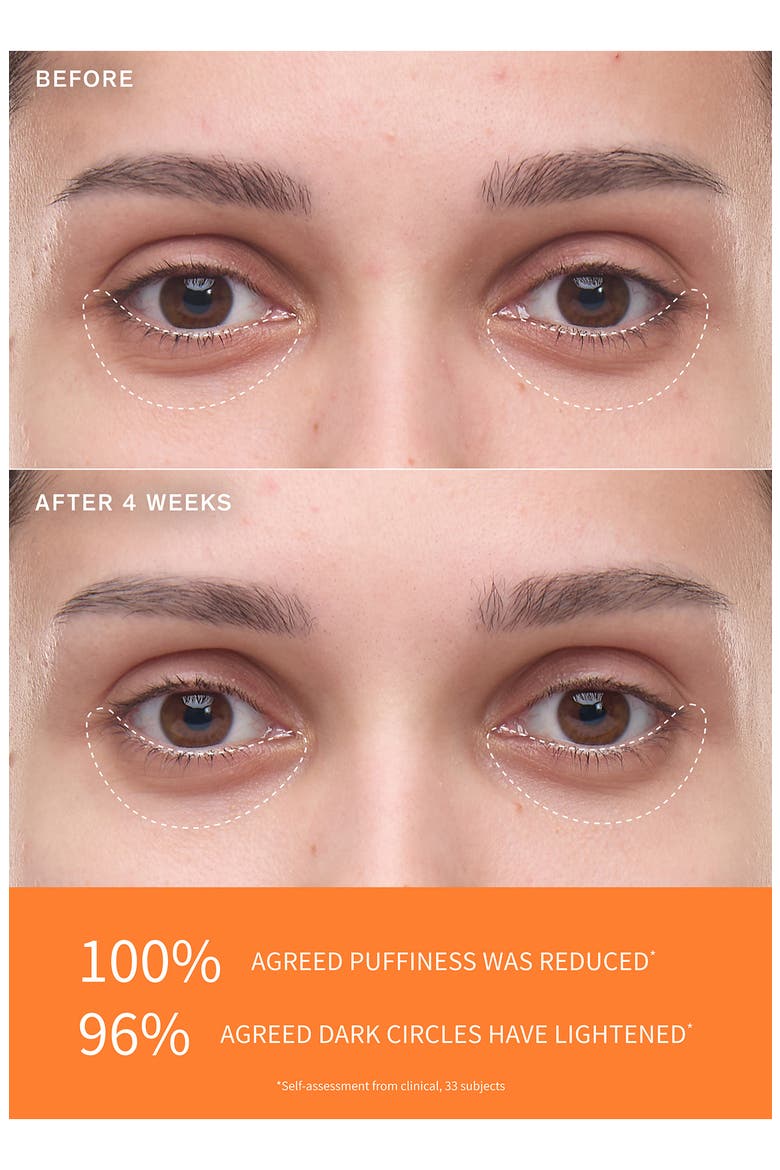 First Care Activating Eye Serum, Alternate, color, NO COLOR
