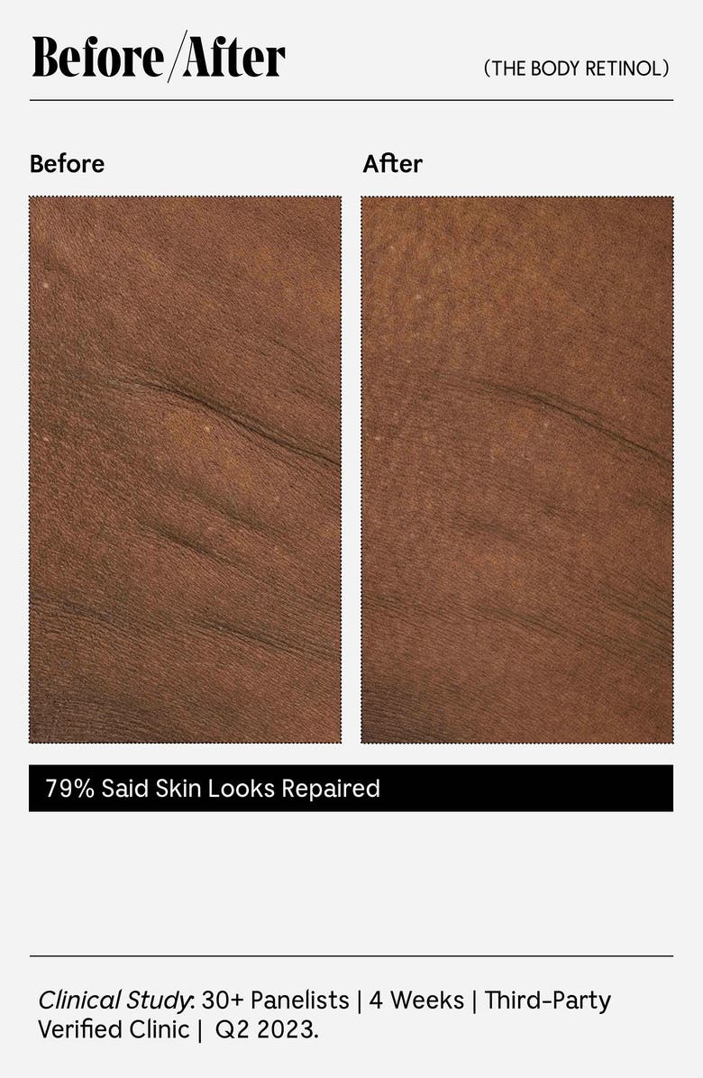 Nécessaire The Body Retinol, Alternate, color,