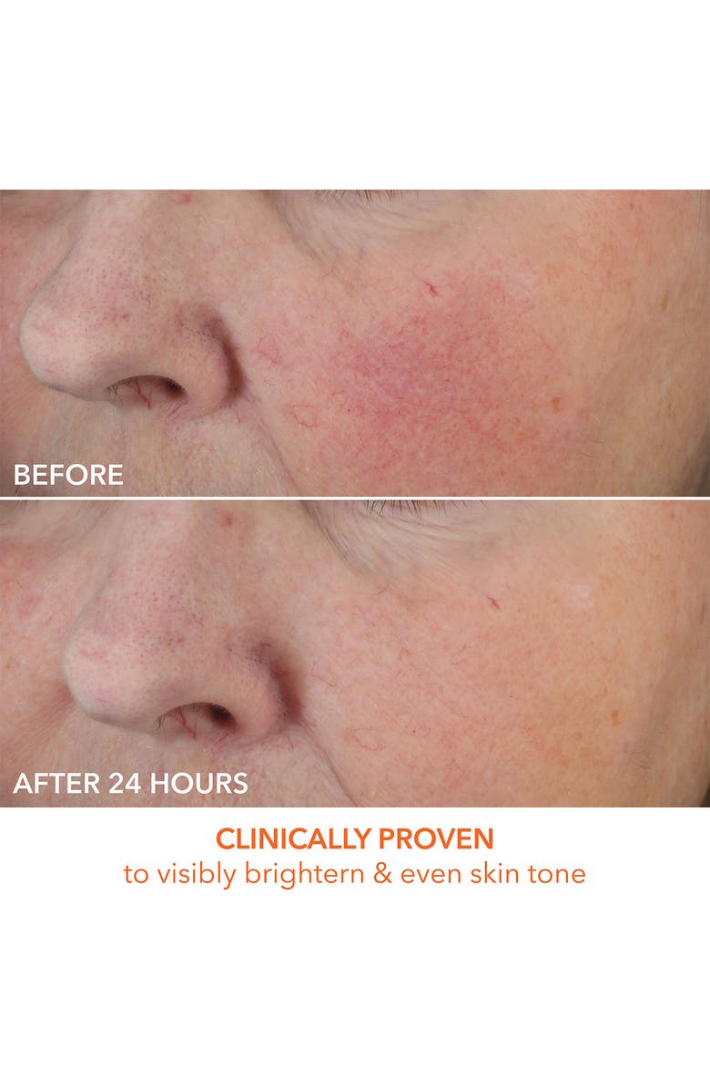 Dr. Dennis Gross Skincare Vitamin C Lactic Dewy Deep Cream, Alternate, color, 